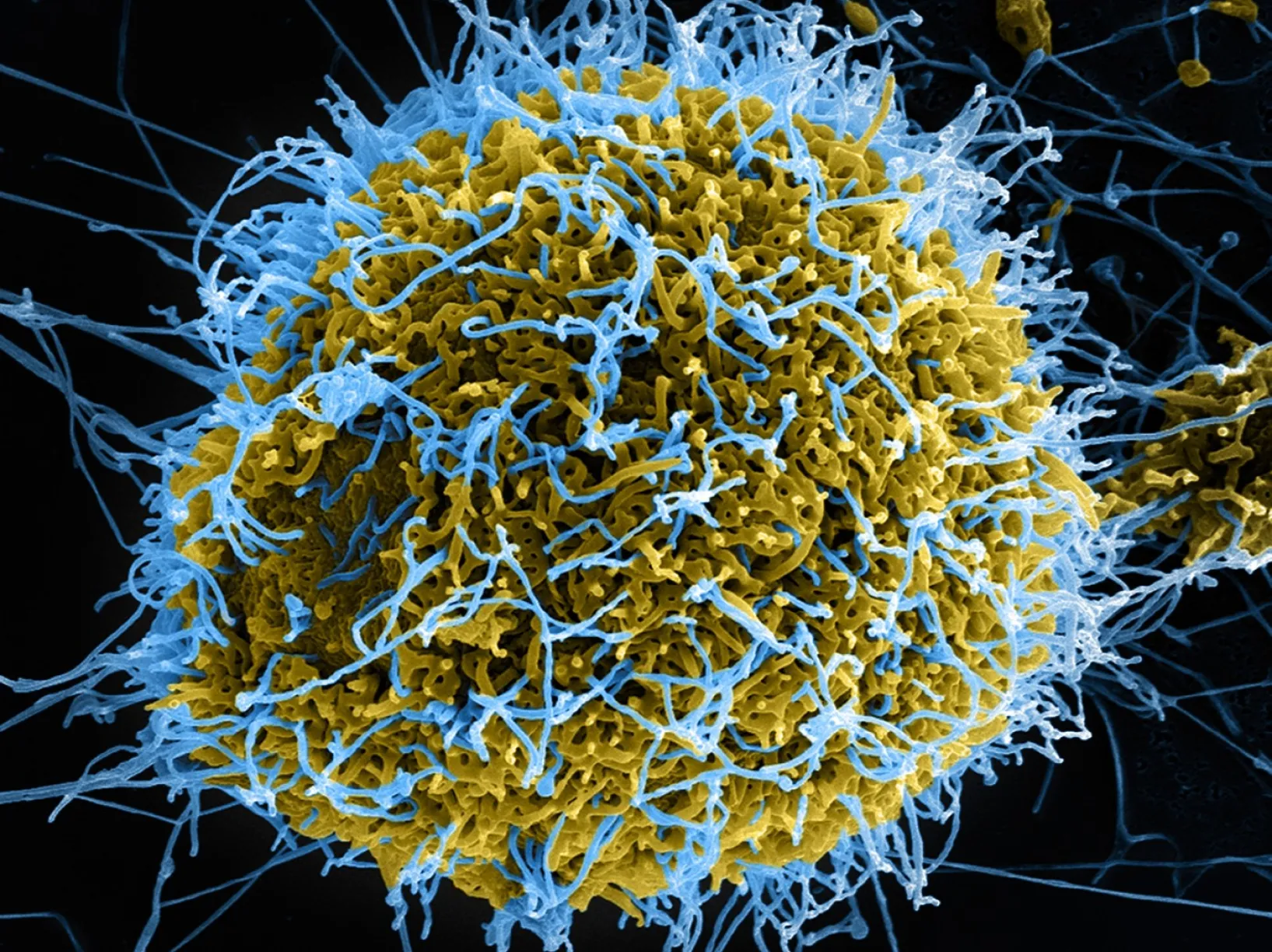 A colorized scanning electron micrograph of Ebola virus particles, in blue, budding from a chronically infected cell. New Ohio State research shows that the cell-signaling activities of proteins from the SERINC family helped protect cells from infection by Ebola, HIV and Zika viruses.