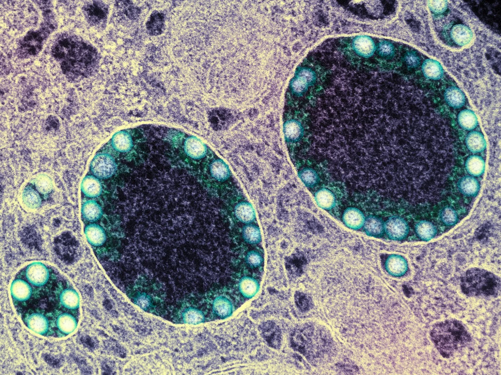 Neutralizing antibodies that block viral particles’ entry into host cells are considered the gold standard of protection against COVID-19 infection. Above, SARS-CoV-2 virus particles are visible inside a heavily infected nasal cell.