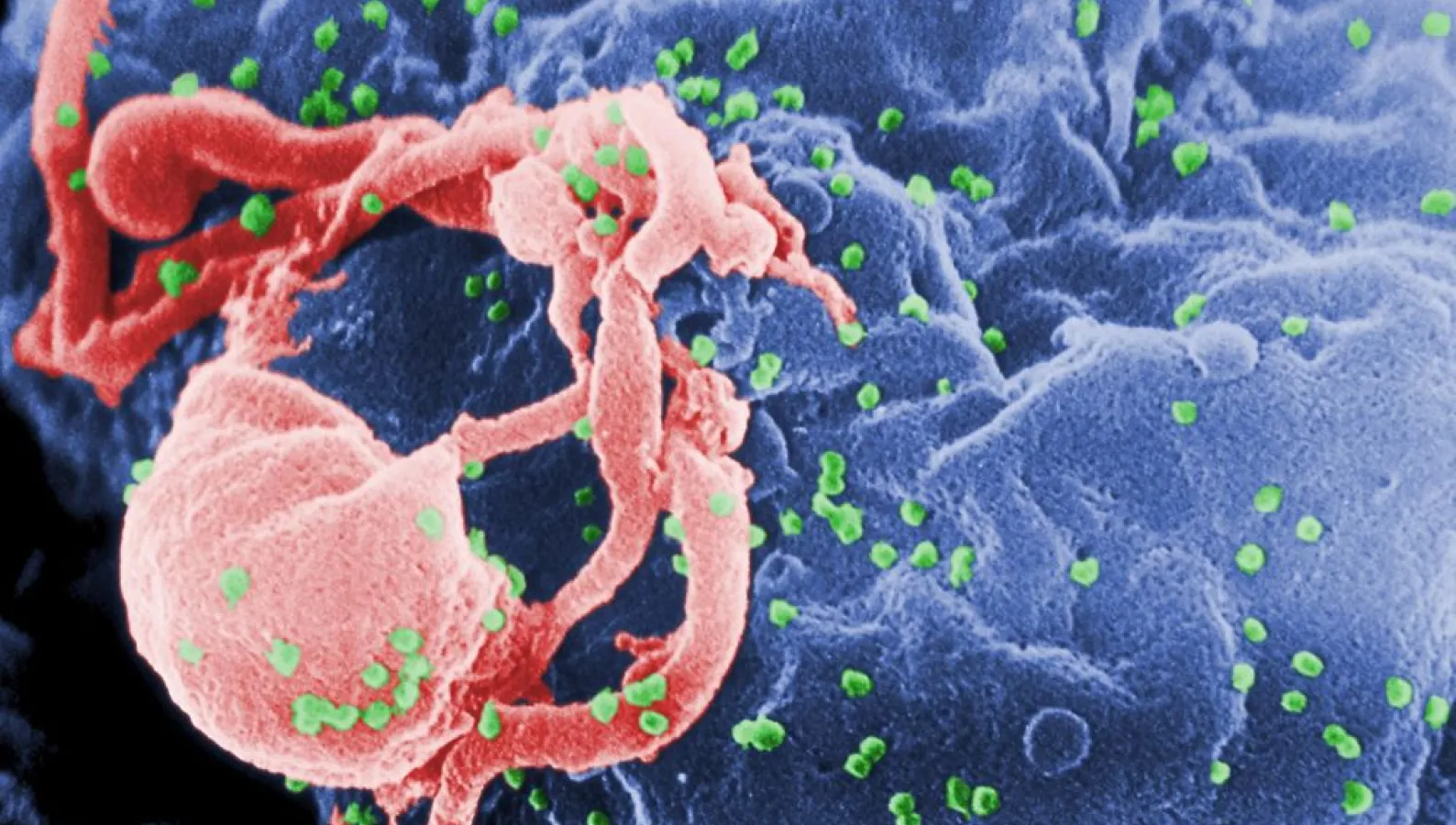 hiv budding color image  molecular