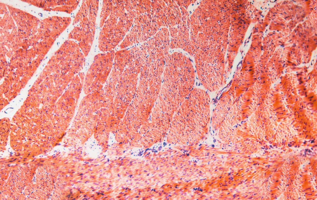 cytology lab sample